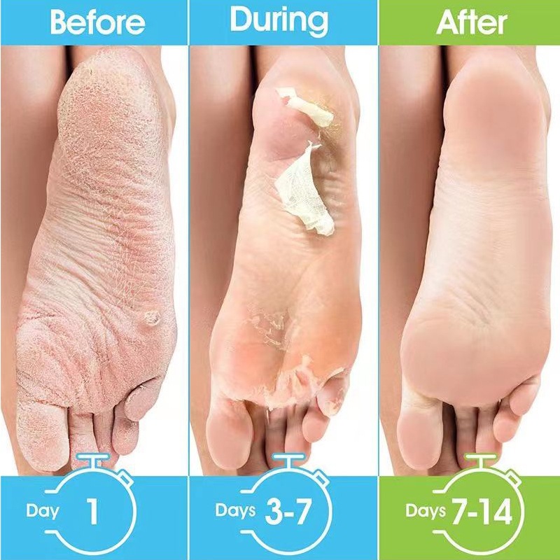 1 Pag=1 Para Maseczek do Stóp  – Foot Mask Peeling recenzja i cena