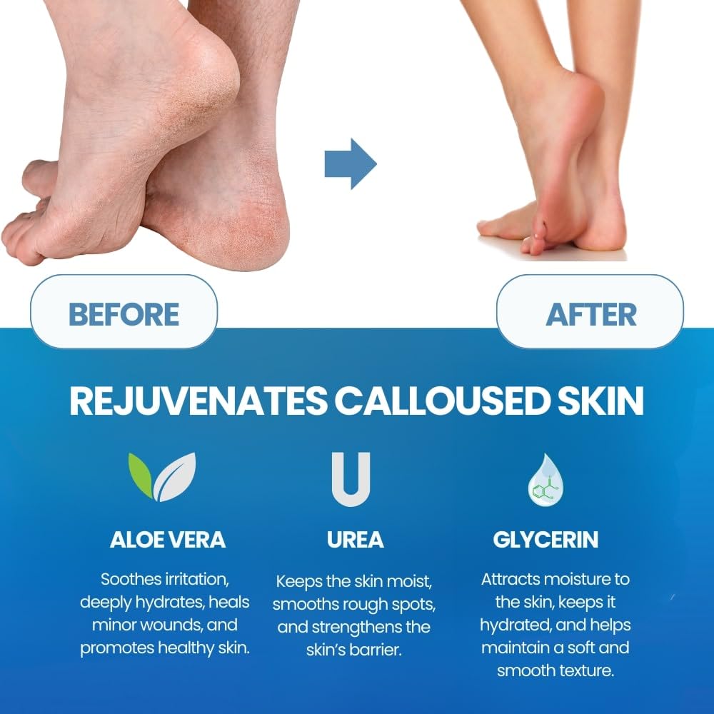 Usuwanie skórek stóp, złuszcza – Foot Mask Peeling recenzja i cena
