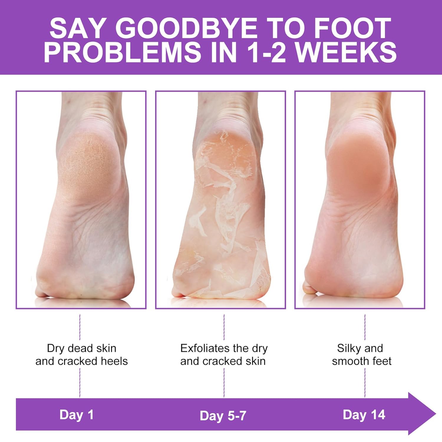Maseczka do stóp z efektem pee – Foot Mask Peeling recenzja i cena