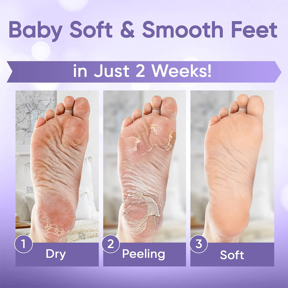 1-20Pair Złuszczająca maska do – Foot Mask Peeling recenzja i cena