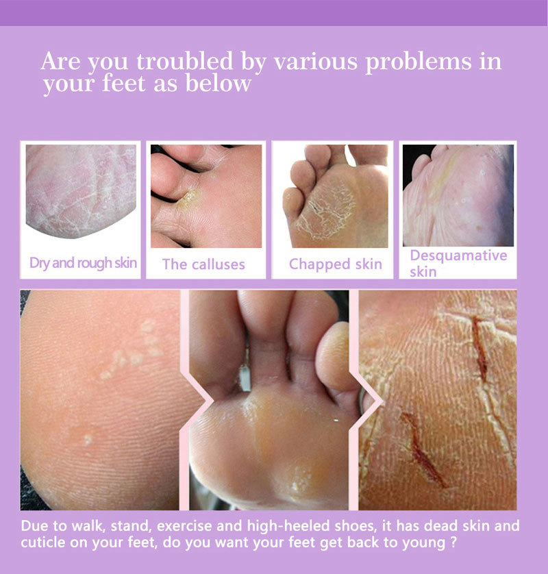 Maseczki złuszczające do stóp, – Foot Mask Peeling recenzja i cena