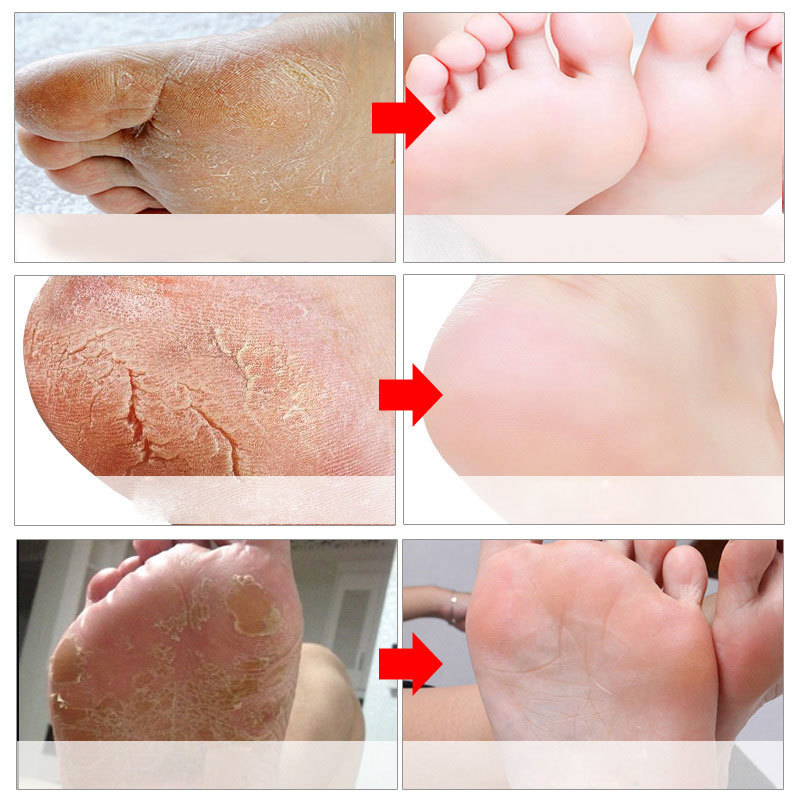 Maseczki złuszczające do stóp, – Foot Mask Peeling recenzja i cena